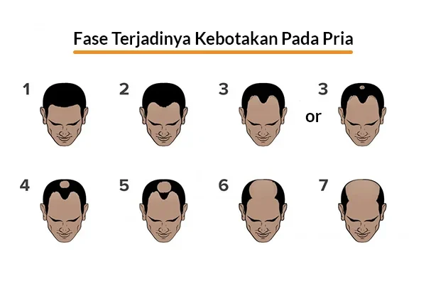 fase-rambut.webp fase-rambut.webp